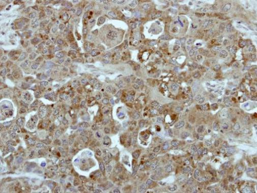 BCR Antibody in Immunohistochemistry (Paraffin) (IHC (P))