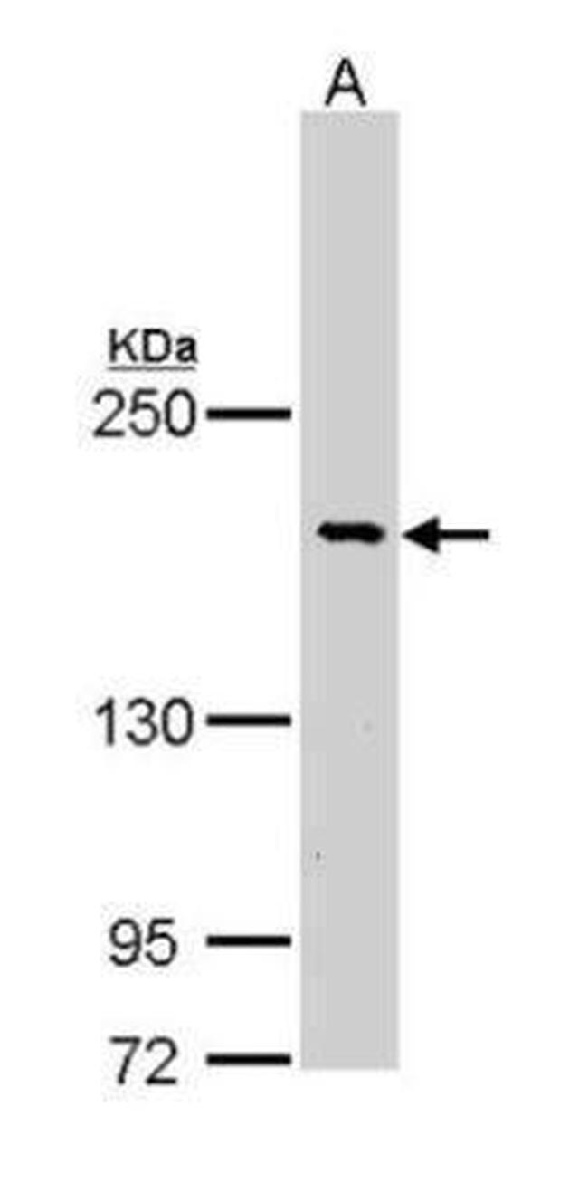 BCR Antibody in Western Blot (WB)