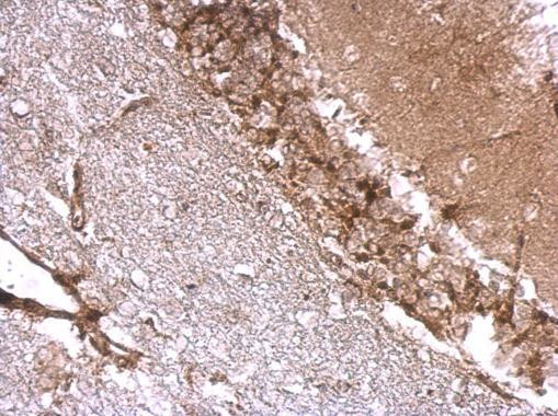 Drebrin Antibody in Immunohistochemistry (Paraffin) (IHC (P))