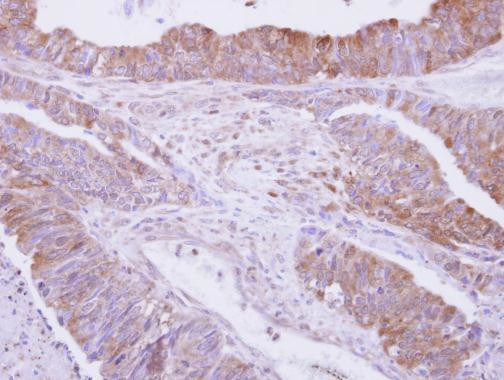 Drebrin Antibody in Immunohistochemistry (Paraffin) (IHC (P))