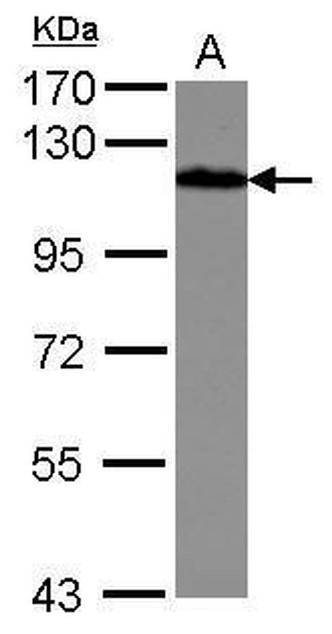 Drebrin Antibody in Western Blot (WB)