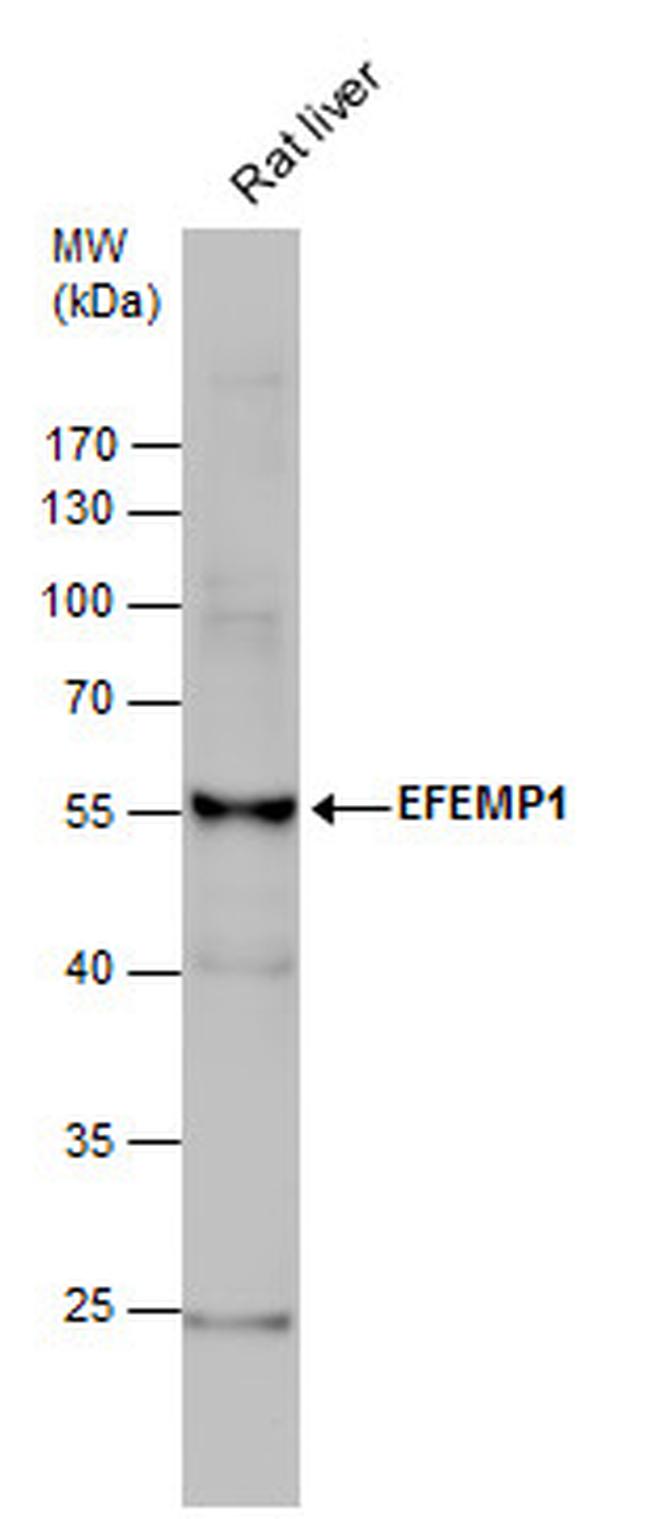 Fibulin 3 Antibody in Western Blot (WB)