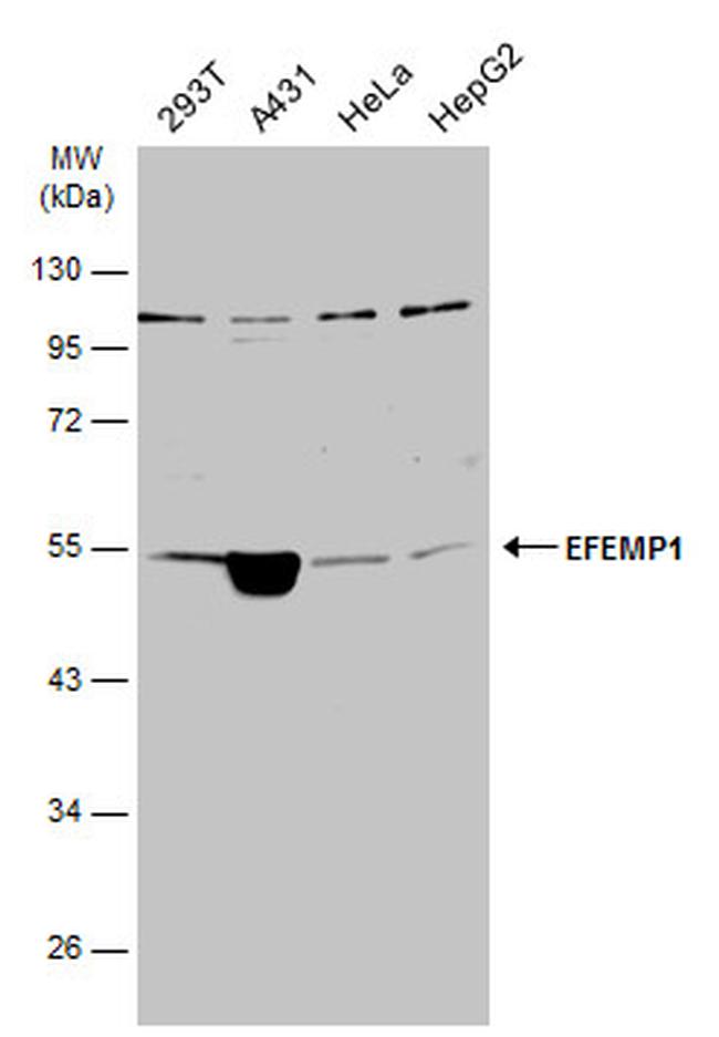 Fibulin 3 Antibody in Western Blot (WB)