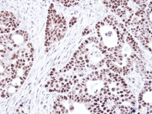 MSH6 Antibody in Immunohistochemistry (Paraffin) (IHC (P))