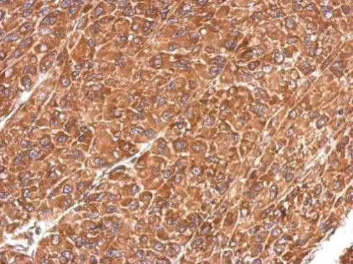 IDE Antibody in Immunohistochemistry (Paraffin) (IHC (P))