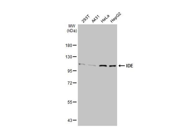 IDE Antibody in Western Blot (WB)