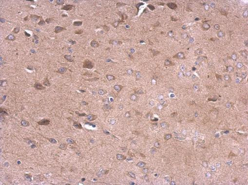 CD10 Antibody in Immunohistochemistry (Paraffin) (IHC (P))