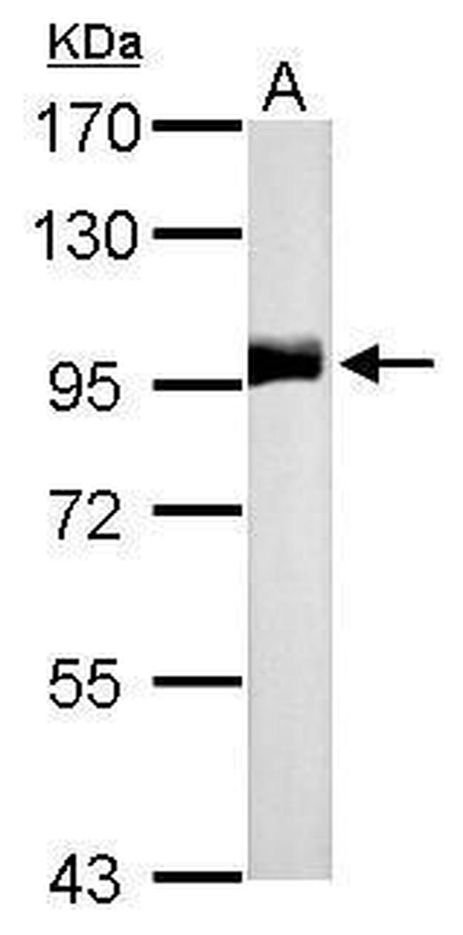 CD10 Antibody in Western Blot (WB)