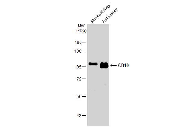 CD10 Antibody in Western Blot (WB)