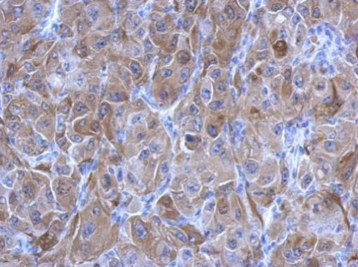 TGM2 Antibody in Immunohistochemistry (Paraffin) (IHC (P))