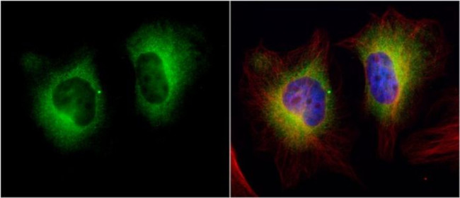 TGM2 Antibody in Immunocytochemistry (ICC/IF)