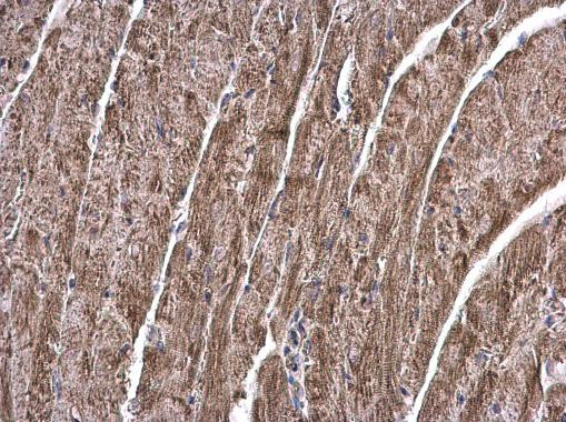 TGM2 Antibody in Immunohistochemistry (Paraffin) (IHC (P))