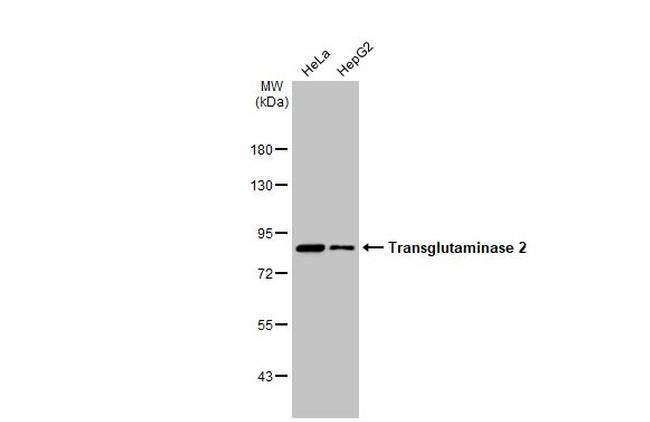 TGM2 Antibody in Western Blot (WB)