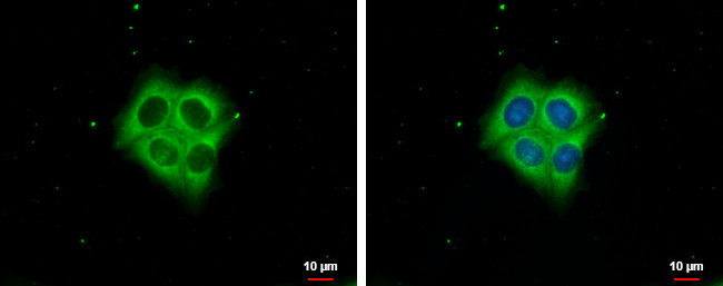 Ezrin Antibody in Immunocytochemistry (ICC/IF)