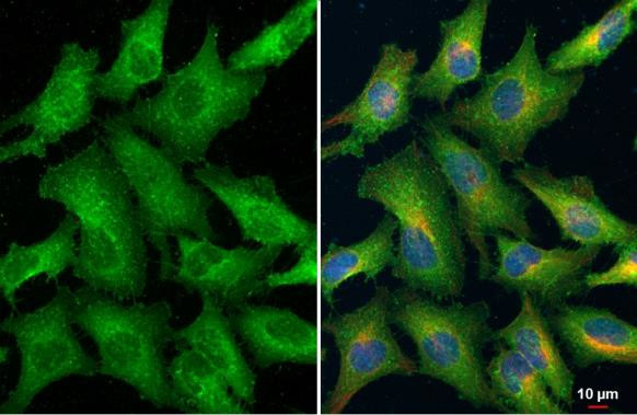 Ezrin Antibody in Immunocytochemistry (ICC/IF)