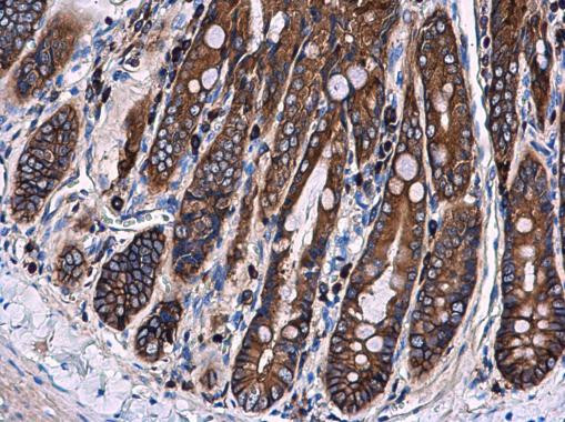 Ezrin Antibody in Immunohistochemistry (Paraffin) (IHC (P))