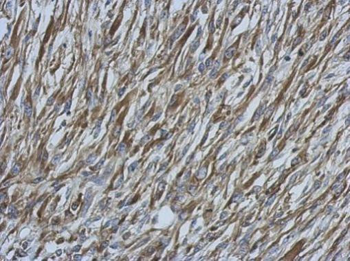 Ezrin Antibody in Immunohistochemistry (Paraffin) (IHC (P))