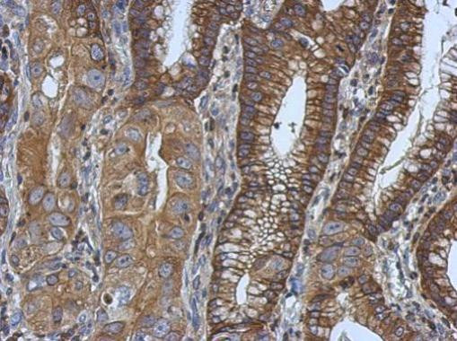 Ezrin Antibody in Immunohistochemistry (Paraffin) (IHC (P))