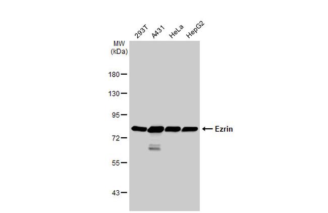 Ezrin Antibody in Western Blot (WB)