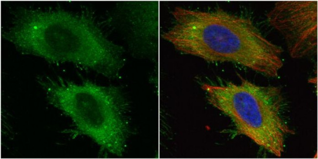 Ezrin Antibody in Immunocytochemistry (ICC/IF)