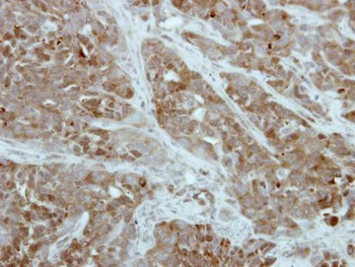 PFKFB1 Antibody in Immunohistochemistry (Paraffin) (IHC (P))