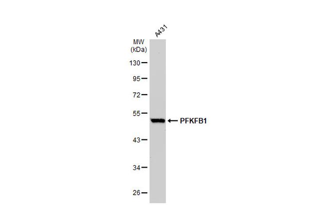 PFKFB1 Antibody in Western Blot (WB)