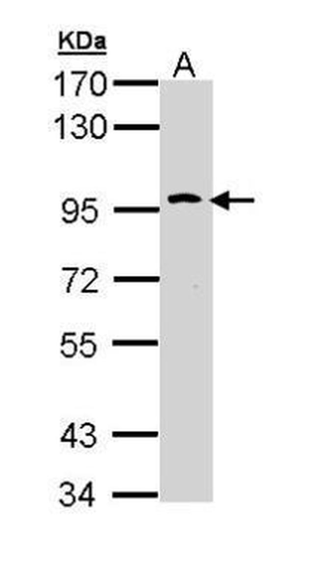TLR10 Antibody in Western Blot (WB)