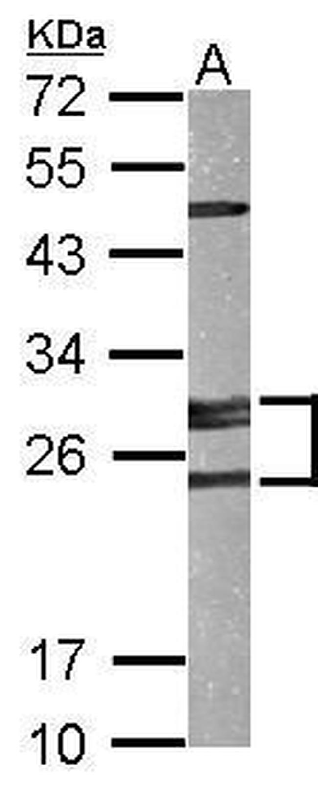 Adenylate Kinase 2 Antibody in Western Blot (WB)