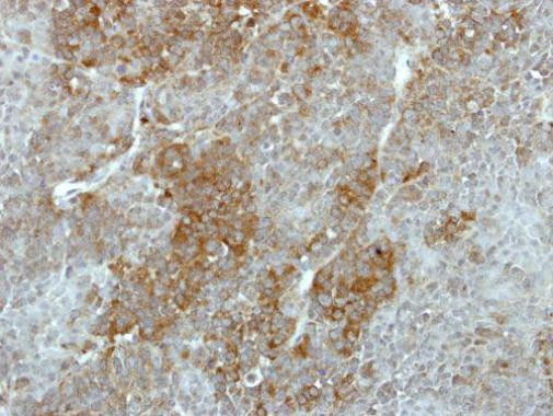 GALK2 Antibody in Immunohistochemistry (Paraffin) (IHC (P))