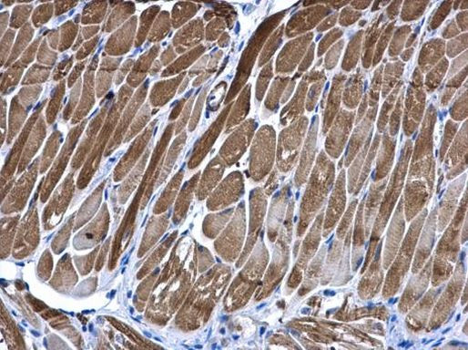 PIP4K2B Antibody in Immunohistochemistry (Paraffin) (IHC (P))