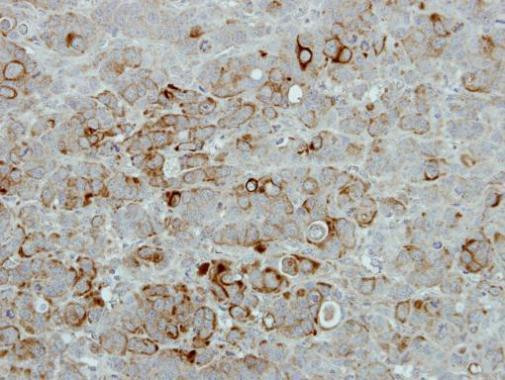 PIP4K2B Antibody in Immunohistochemistry (Paraffin) (IHC (P))