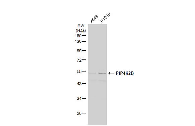 PIP4K2B Antibody in Western Blot (WB)