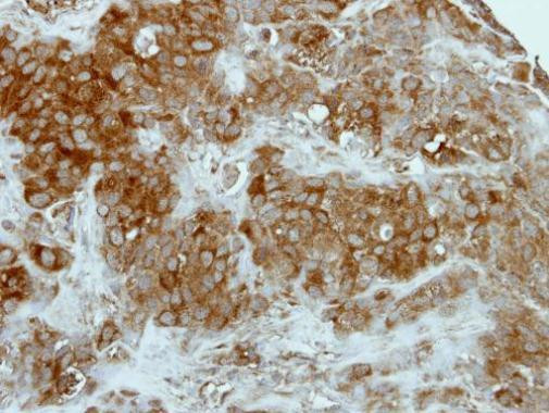 GCLM Antibody in Immunohistochemistry (Paraffin) (IHC (P))