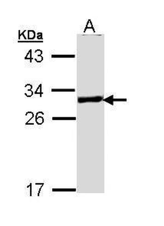 GCLM Antibody in Western Blot (WB)