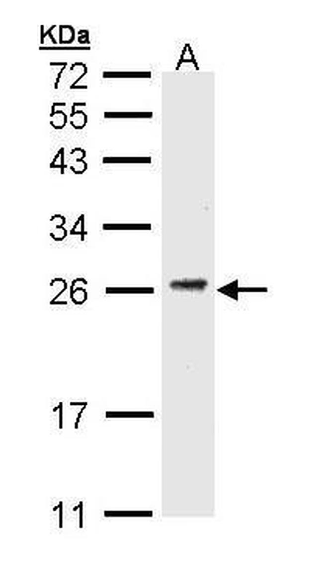 CD3g Antibody in Western Blot (WB)