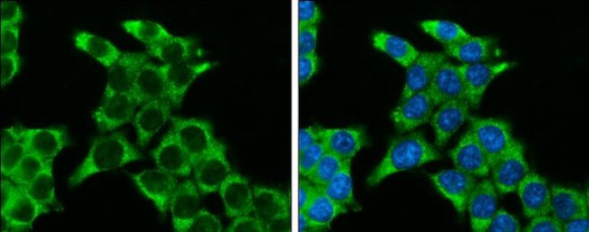 SFRP2 Antibody in Immunocytochemistry (ICC/IF)