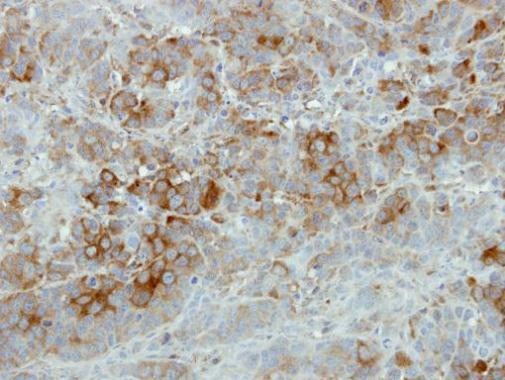 SFRP2 Antibody in Immunohistochemistry (Paraffin) (IHC (P))