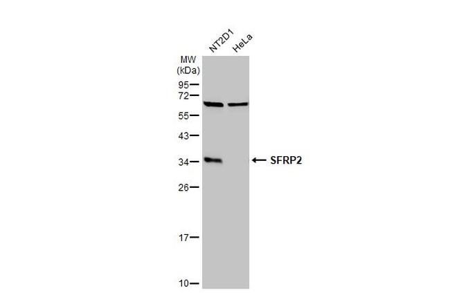 SFRP2 Antibody in Western Blot (WB)