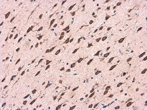 CDK5RAP1 Antibody in Immunohistochemistry (Paraffin) (IHC (P))