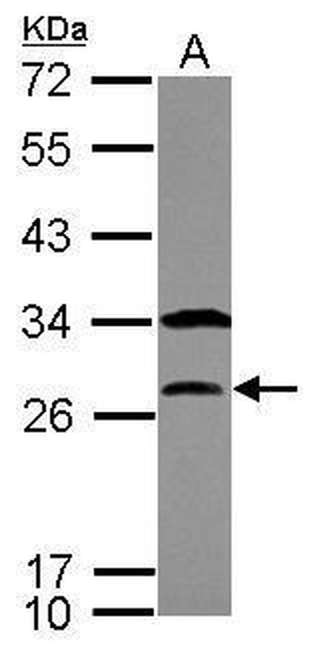 Securin Antibody in Western Blot (WB)