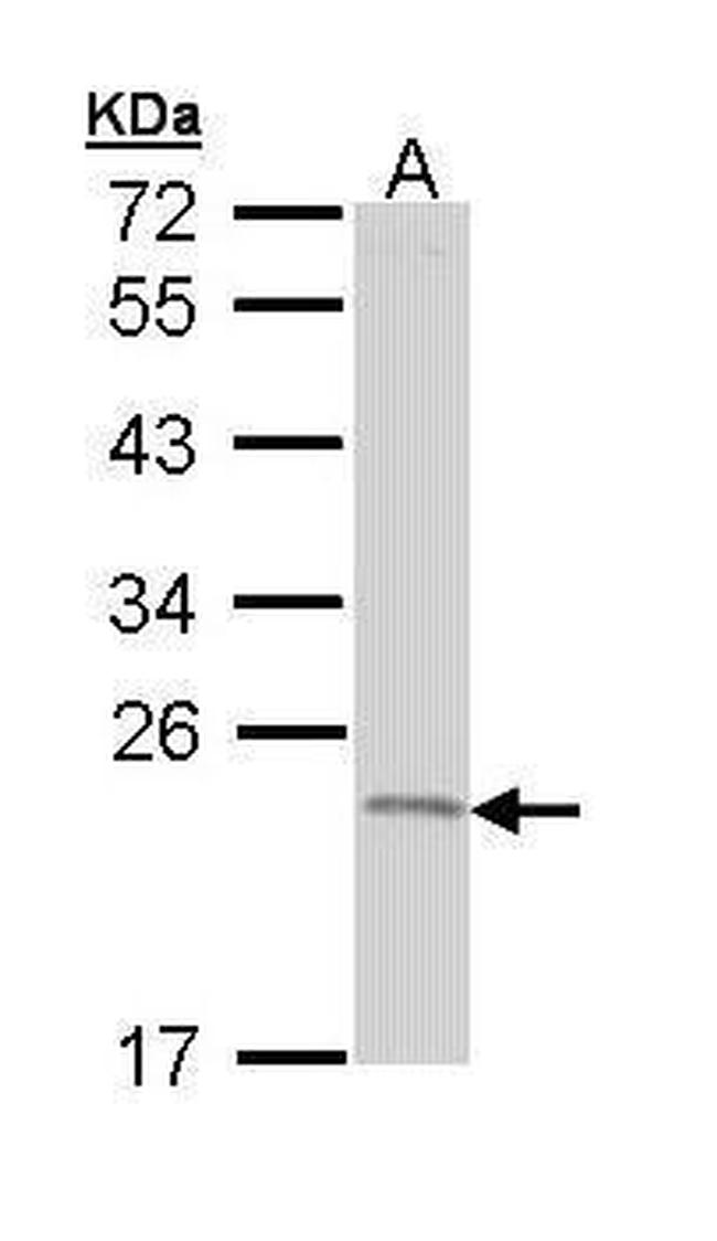 TNFAIP8 Antibody in Western Blot (WB)