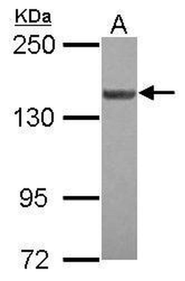 LOK Antibody in Western Blot (WB)