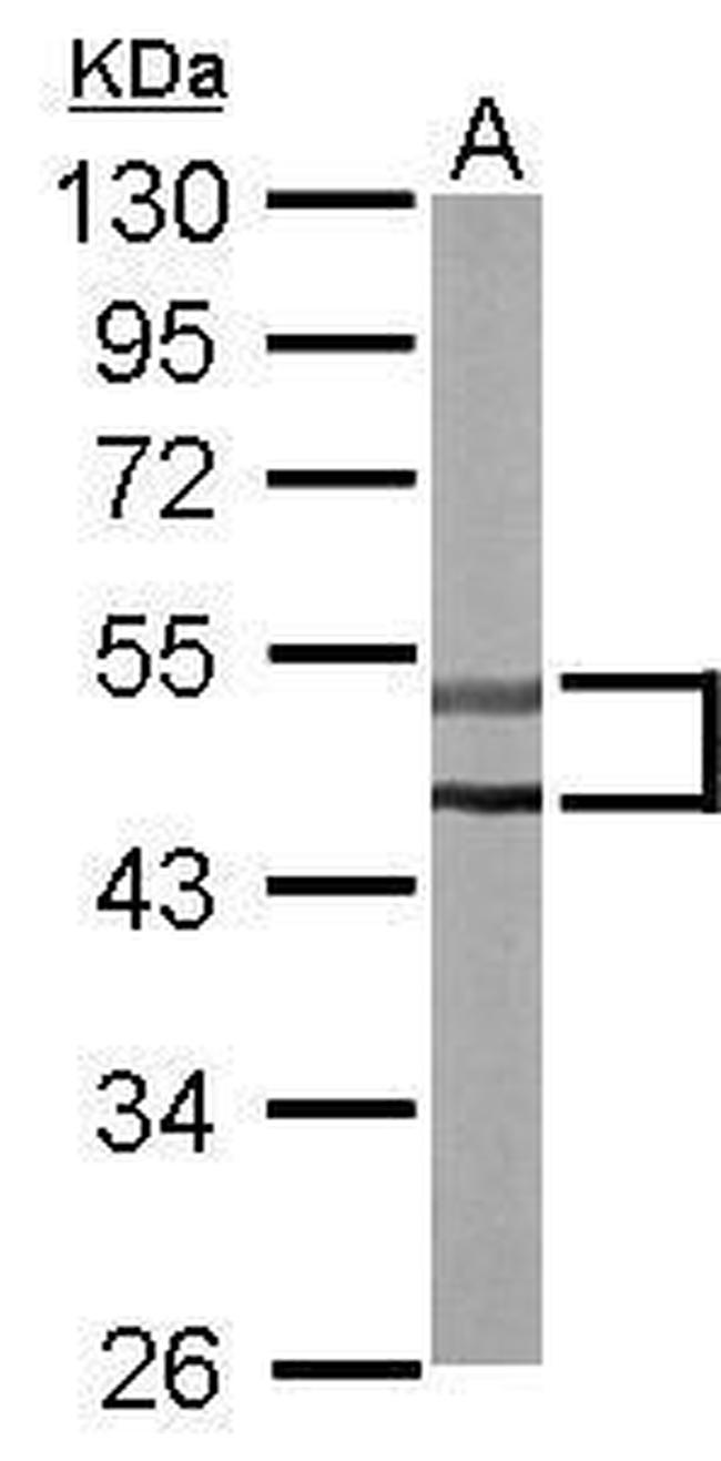 STK32C Antibody in Western Blot (WB)