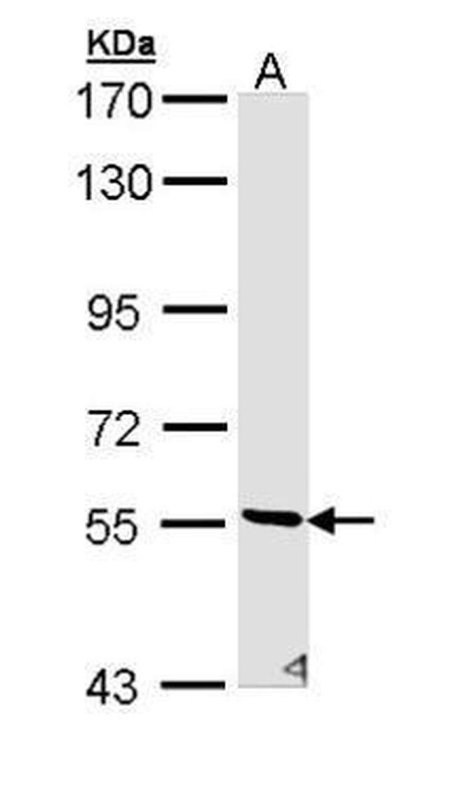 STK32C Antibody in Western Blot (WB)