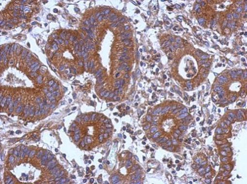 STK16 Antibody in Immunohistochemistry (Paraffin) (IHC (P))