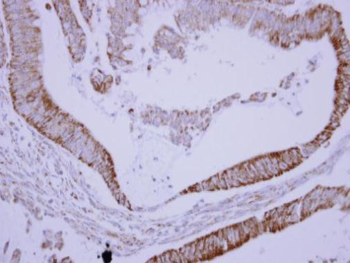 SAB Antibody in Immunohistochemistry (Paraffin) (IHC (P))