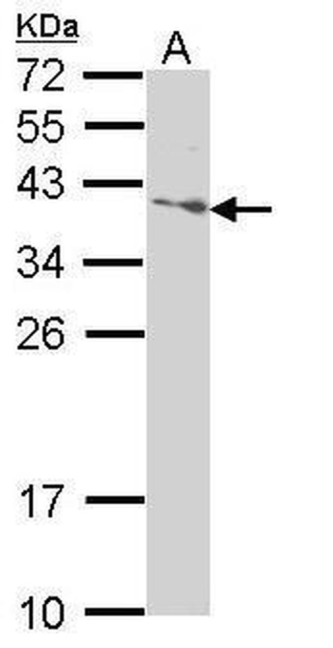 SAP30BP Antibody in Western Blot (WB)