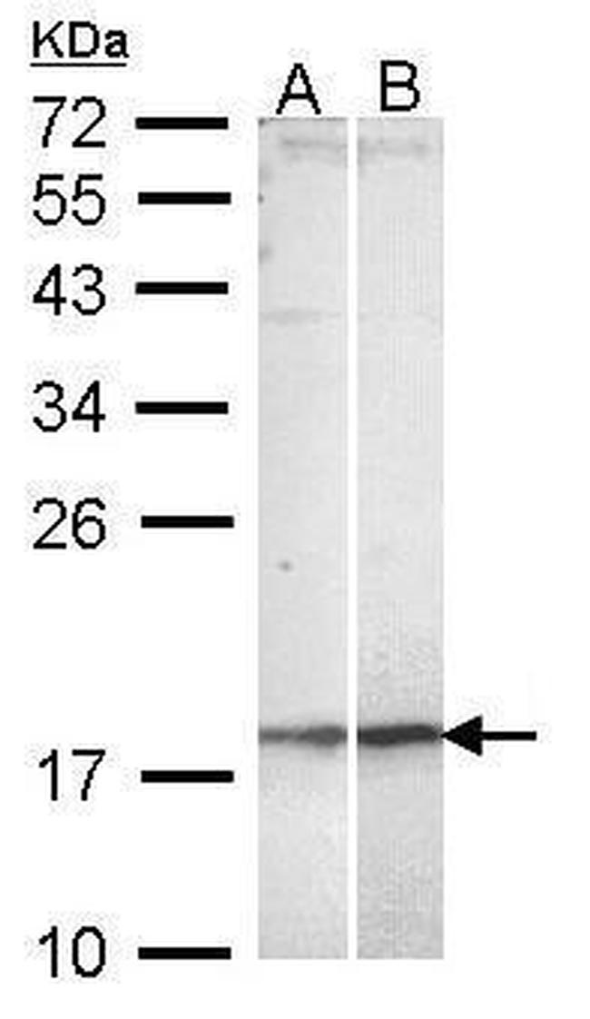 KappaB ras2 Antibody in Western Blot (WB)