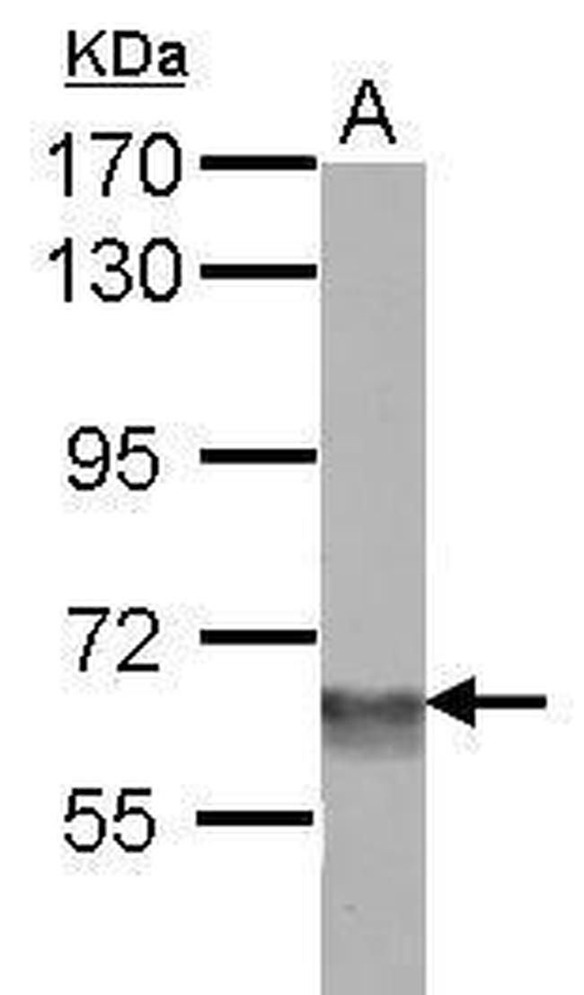 BAF60C Antibody in Western Blot (WB)