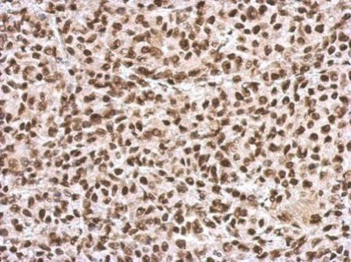 SFPQ Antibody in Immunohistochemistry (Paraffin) (IHC (P))